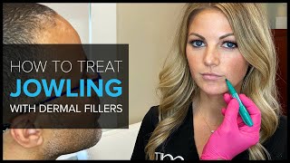 FAQ Bay Area Expert Shows How to Treat Jowls with Dermal Fillers [upl. by Freddie]