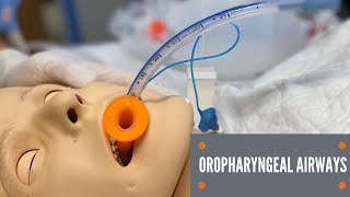 Oropharyngeal Airway Insertion [upl. by Nivak698]