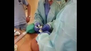 Airway Management During a Difficult Intubation Case [upl. by Eve]