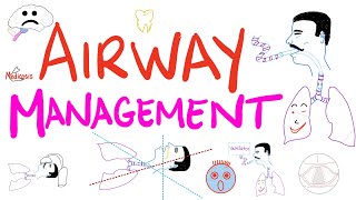 Airway Management  Tracheal Intubation  Anesthesiology Series [upl. by Eded111]